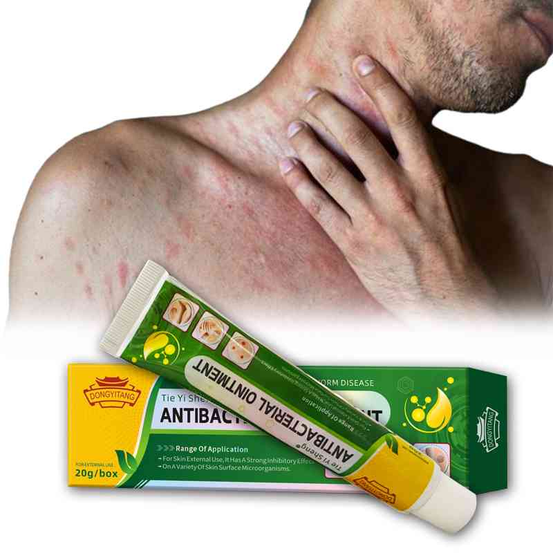 Crème qui élimine les démangeaisons et boutons en moins de 24h !