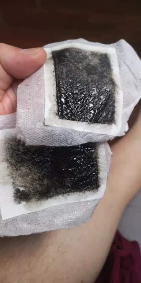 Kit de 10 patchs détoxifiant pour le corps "kinoki" (100% naturel)