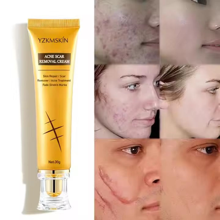 Le gel cicatrisant anti-acné et anti-cicatrices