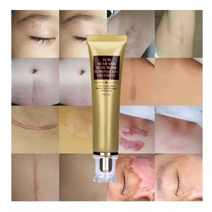 Le gel cicatrisant anti-acné et anti-cicatrices