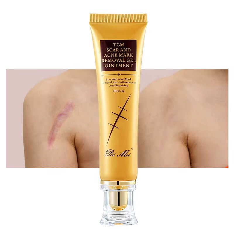 Le gel cicatrisant anti-acné et anti-cicatrices