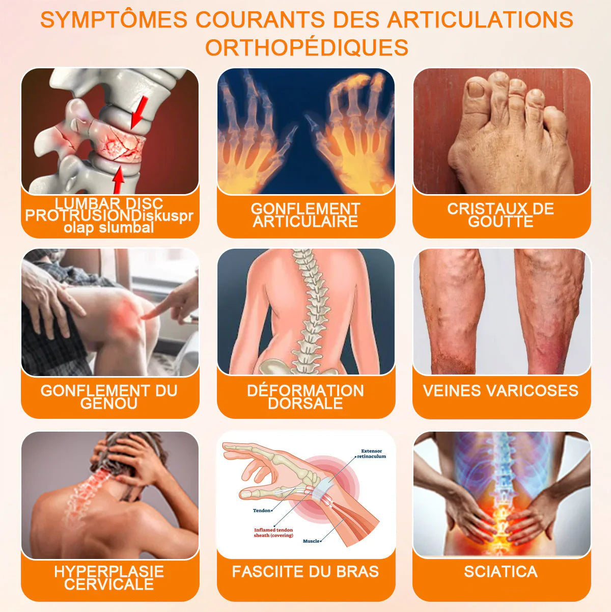 Venin d'abeille Crème de traitement de l'arthrite au venin d'abeille