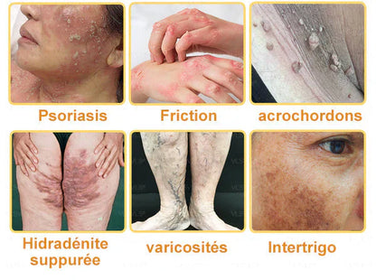 Venin d'abeille Crème de traitement de l'arthrite au venin d'abeille