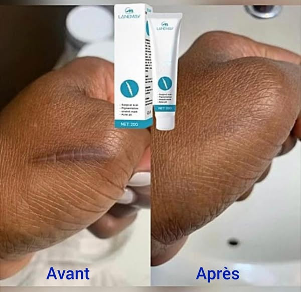 CRÈMES CICATRICES ET VERGETURES