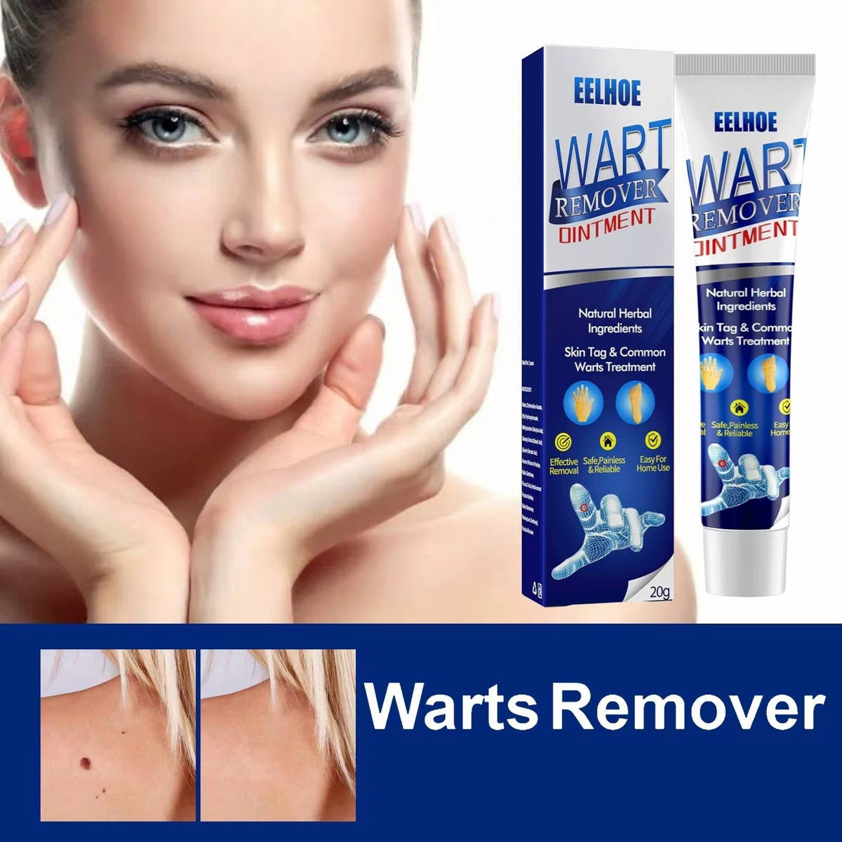 Crème pour enlever les verrues, indolore, sérum pour enlever les grains de beauté, les taches brunes, les verrues