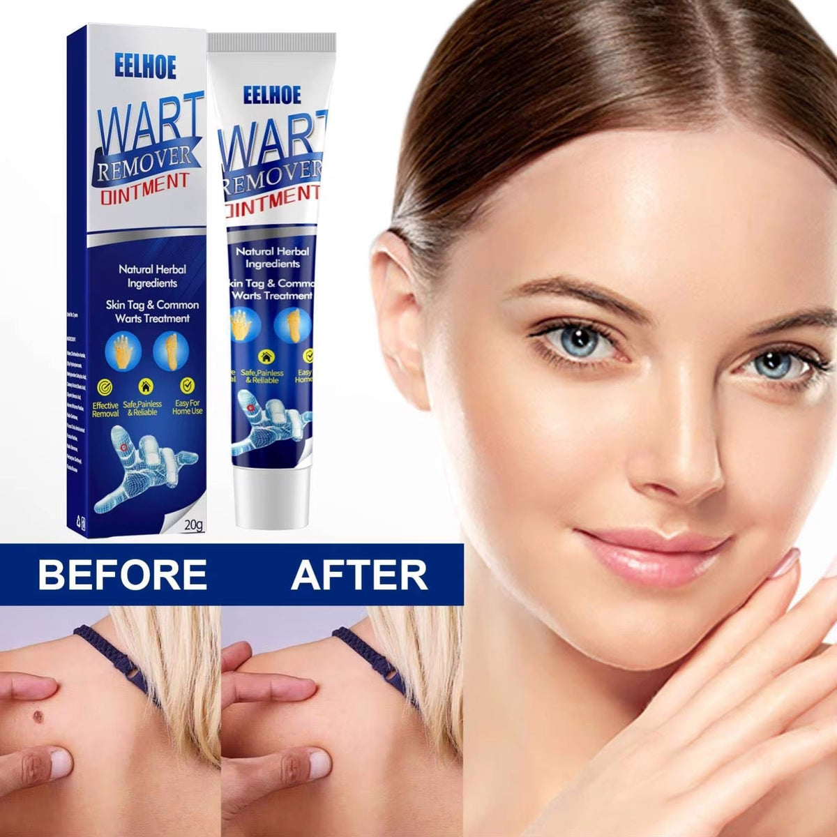 Crème pour enlever les verrues, indolore, sérum pour enlever les grains de beauté, les taches brunes, les verrues
