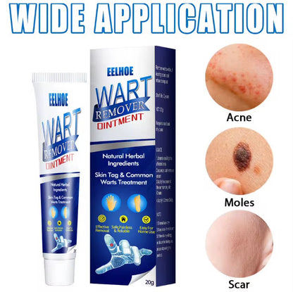 Crème pour enlever les verrues, indolore, sérum pour enlever les grains de beauté, les taches brunes, les verrues
