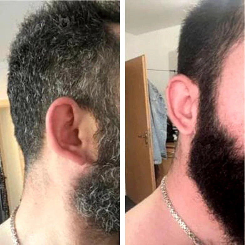 Shampooing d'huile pour éliminer les cheveux et barbes blanche
