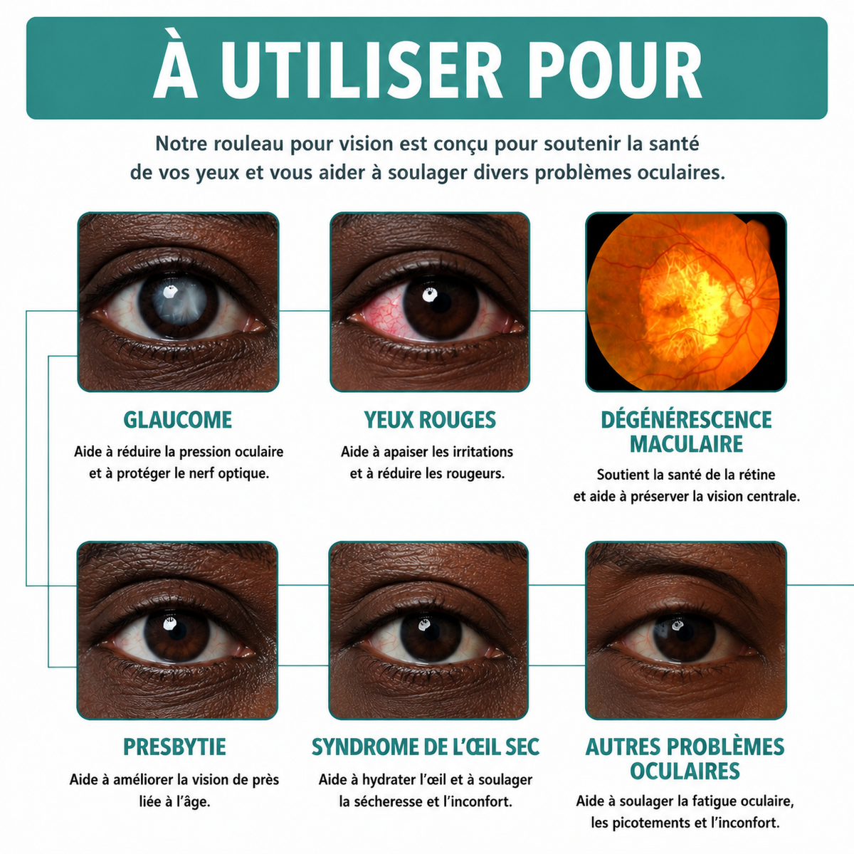✅ Roller Vision – Retrouvez une vue plus claire clairement