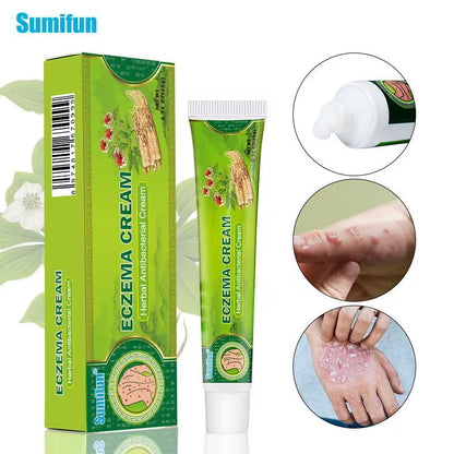 Eczema Cream – Herbal Antibacterial Cream